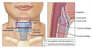 Throat Treatment in Nashik